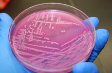 ФГБУ «ВГНКИ» поданы заявки на патентование новых штаммов Escherichia coli для разработки вакцины против колибактериоза